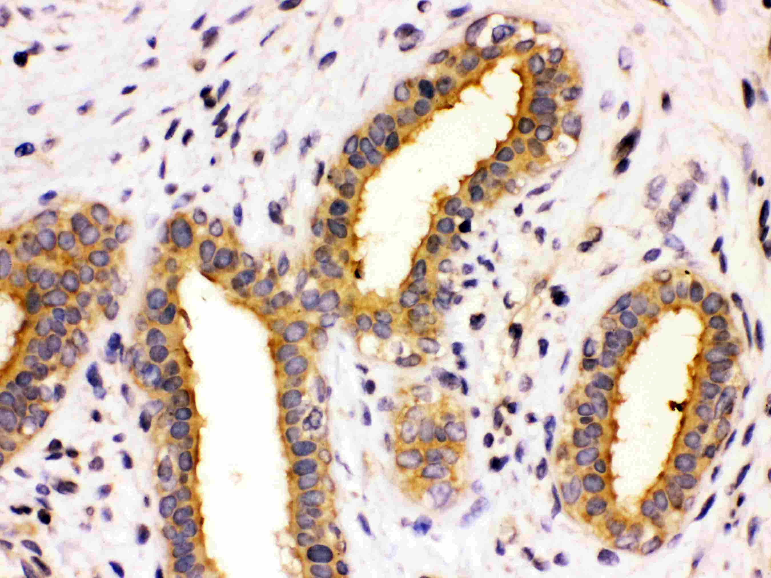 Polyclonal Rabbit anti-Human CCT8 Antibody (IHC, WB)