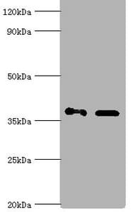 Polyclonal Rabbit anti-Human AKR1C4 / Chlordecone Reductase Antibody (aa1-323, IHC, WB)