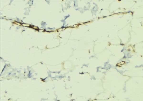 DMTN / Dematin Antibody (phospho-Ser403)