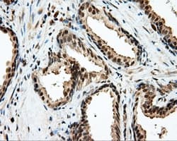Monoclonal Mouse anti-Human LIPG / Endothelial Lipase Antibody (clone OTI3G7, IHC, WB)