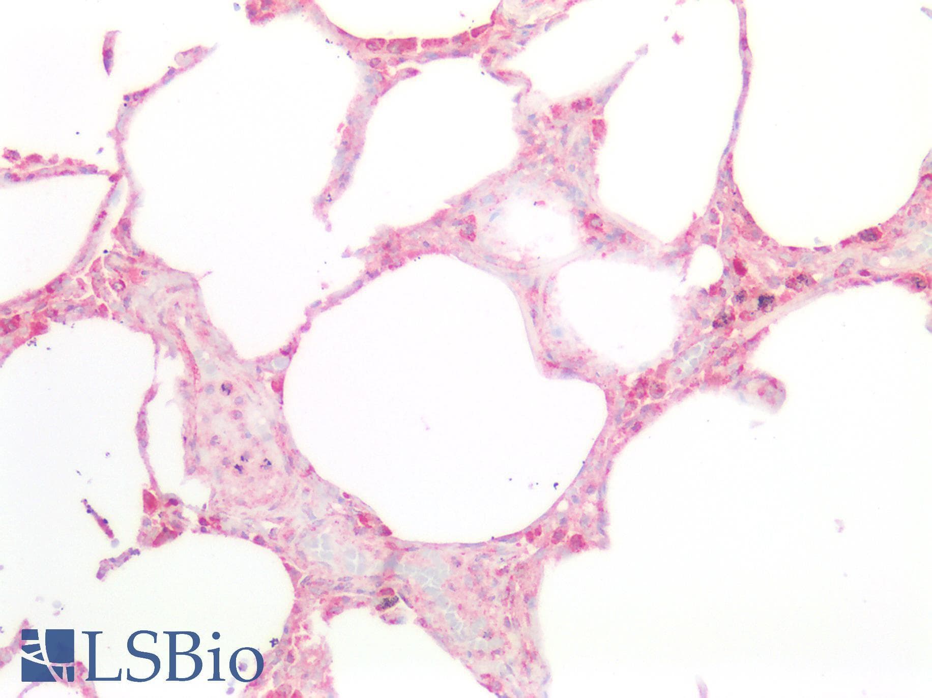 IHC-plus™ Polyclonal Rabbit anti-Human TGFBR1 / ALK5 Antibody (IHC, IF, WB)