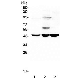 ELAVL2 / HUB Antibody
