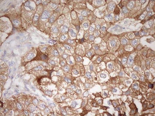 CDH1 / E Cadherin Antibody (clone UMAB184)