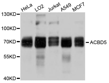 Polyclonal Rabbit anti-Human ACBD5 Antibody (WB)