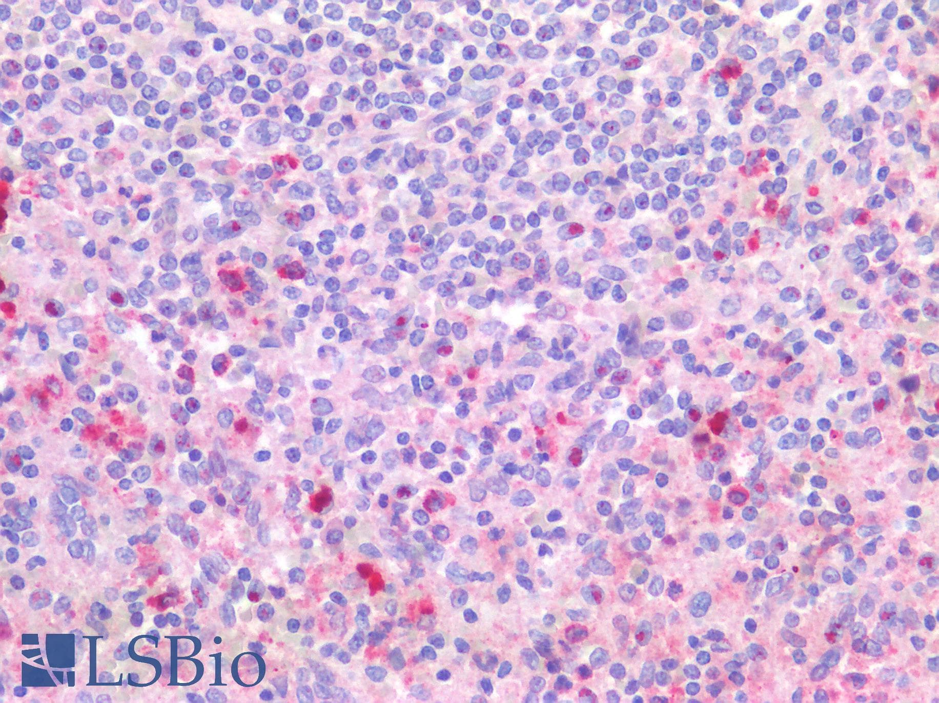 IHC-plus™ TLR8 Antibody