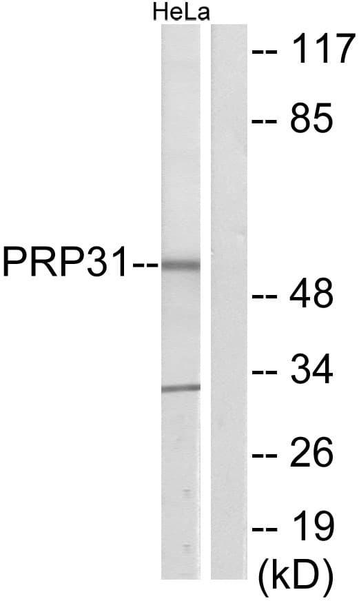 PRPF31 Antibody (aa331-380)