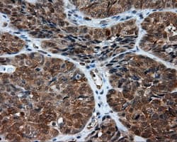 NPR3 Antibody (clone OTI4C3)