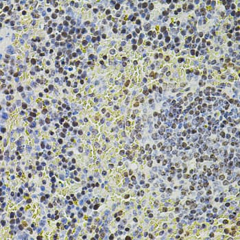 POT1 Antibody