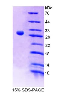 Mouse IL9R / CD129 Protein (Recombinant His-T7)