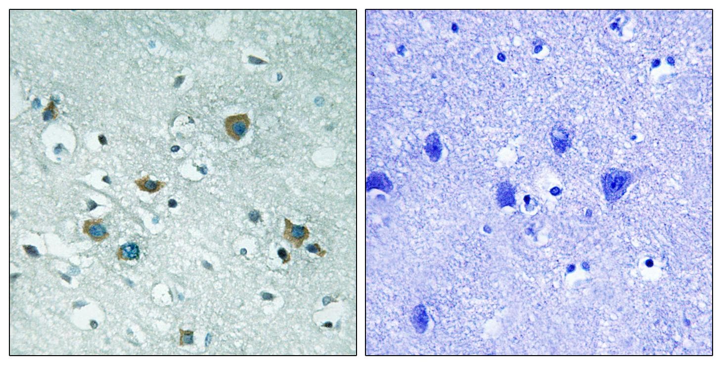 DPYSL2 / CRMP2 Antibody (phospho-Thr509)