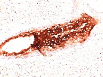 KRT17 / CK17 / Cytokeratin 17 Antibody (clone SPM560)