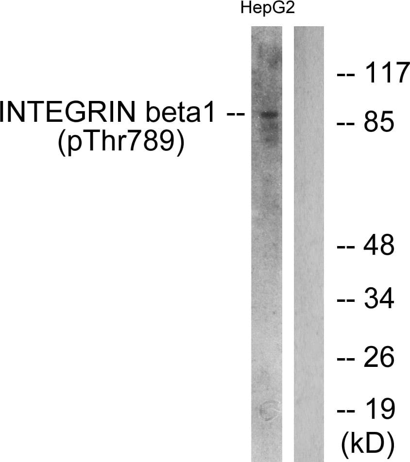 Polyclonal Rabbit anti-Human ITGB1 / Integrin Beta 1 / CD29 Antibody (phospho-Thr789, IHC, IF, WB)