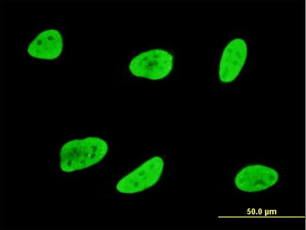 IHC-plus™ SGK1 / SGK Antibody (clone 3G8)