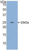 Human GSTP1 / GST Pi Protein (Recombinant His, N-Terminal)