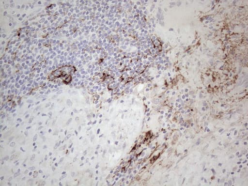 CLU / Clusterin Antibody (aa23-227, clone OTI5D3, Carrier-free)
