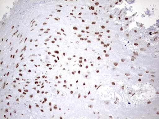 HNRPM / HNRNPM Antibody (aa1-261, clone OTI4C9)