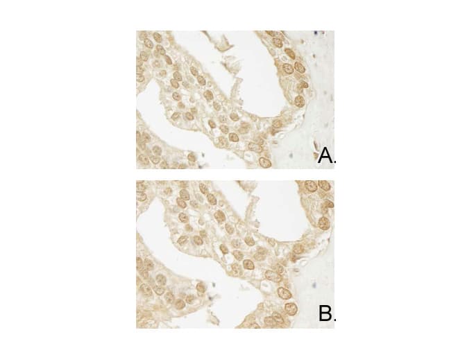 AKT3 Antibody (Internal, clone 25F6.F6.D8, RPE)