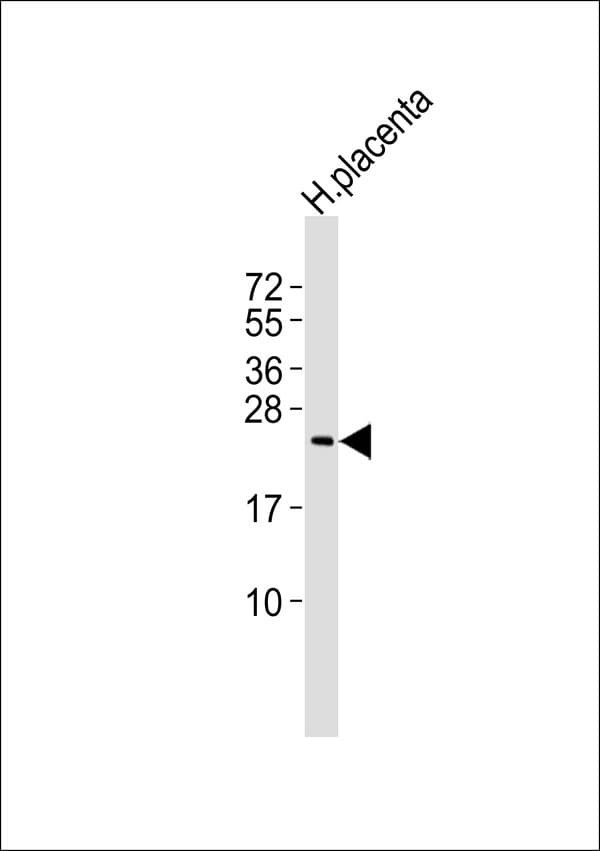 TC21 / RRAS2 Antibody