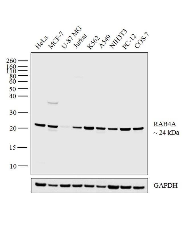 Monoclonal Mouse anti-Human RAB4A / RAB4 Antibody (clone 4E+11, IHC, WB)