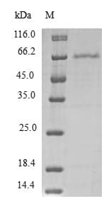 Human PDCD2L Protein (Recombinant GST, N-terminus)