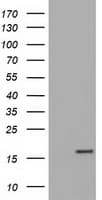 Monoclonal Mouse anti-Human TTC32 Antibody (clone OTI4D4, IHC, IF, WB)