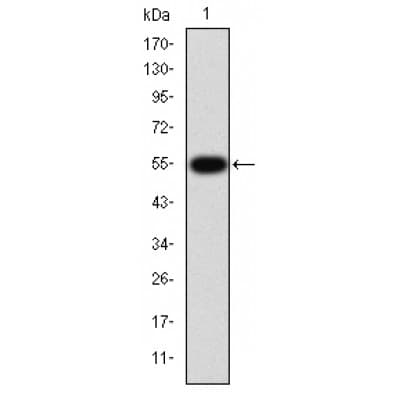 IHC-plus™ Polyclonal Rabbit anti-Human TGFBR1 / ALK5 Antibody (IHC, IF, WB)