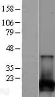 NUDT2 Protein (Over-Expression Lysate Myc-DDK (Flag))