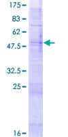 Human OR52B6 Protein (Recombinant GST)