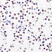 Polyclonal Rabbit anti-Human ZNF264 Antibody (IHC, IF, WB)