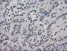 NEK6 Antibody (clone OTI5D7)