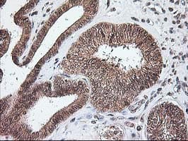 NUDT9 Antibody (clone OTI7A12)