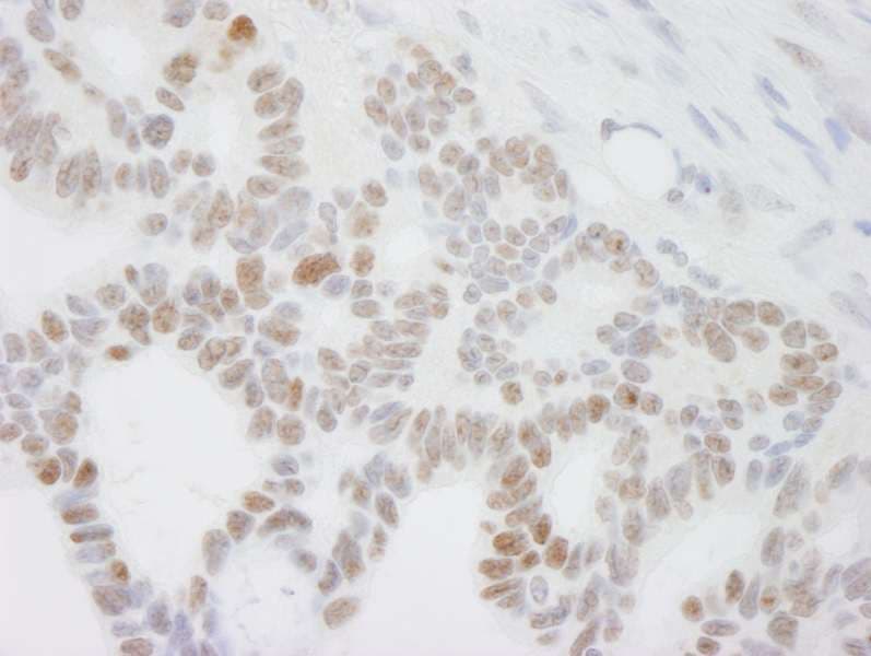 DDX24 Antibody (aa800-C-term)