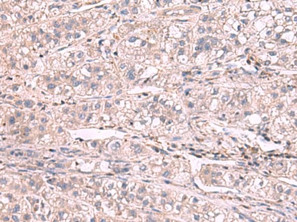 Polyclonal Rabbit anti-Human KCNIP1 / KCHIP1 Antibody (IHC)