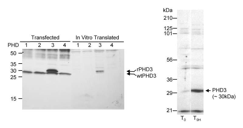 IHC-plus™ Polyclonal Rabbit anti-Human EGLN3 / PHD3 Antibody (aa50-100, IHC, WB)