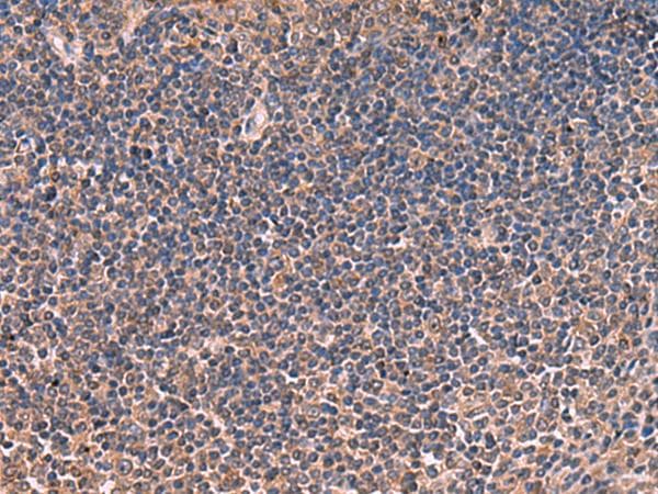 ITIH4 Antibody