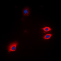 GFAP Antibody (N-Terminus)