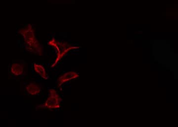 COL4A1 / Collagen IV Alpha1 Antibody