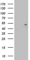 KRT20 / CK20 / Cytokeratin 20 Antibody (clone OTI6G4)