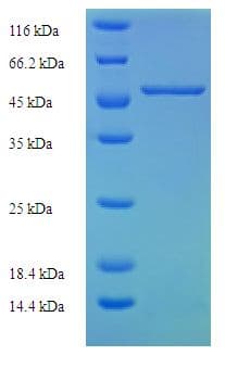 Human SLC25A30 Protein (Recombinant His-SUMO)