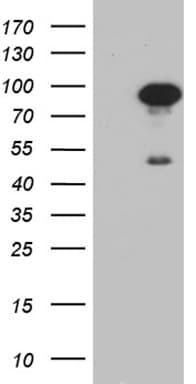 SCG2 / Secretogranin II Antibody (aa31, clone OTI3F12)