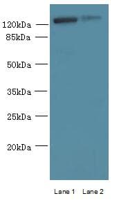 Polyclonal Rabbit anti-Human MCM9 Antibody (IHC, WB)