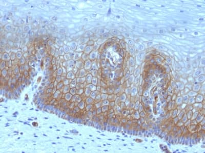 Recombinant Monoclonal Mouse anti-Human THBD / CD141 / Thrombomodulin Antibody (clone rTHBD/1591, Azide-free,Carrier-free, aa 69-194, IHC)