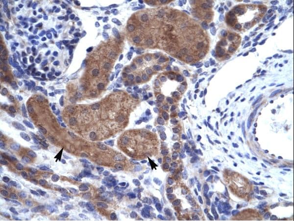 IKZF2 / HELIOS Antibody (aa396-445)