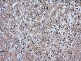 ACAT2 Antibody (clone OTI3E2)
