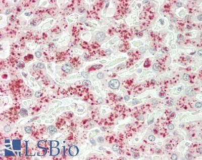 IHC-plus™ RAB8B Antibody (C-Terminus)