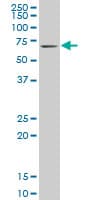 IHC-plus™ KLF11 Antibody (clone 10D8)