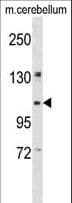 Kinesin Heavy Chain / KIF5B Antibody (aa867-895)