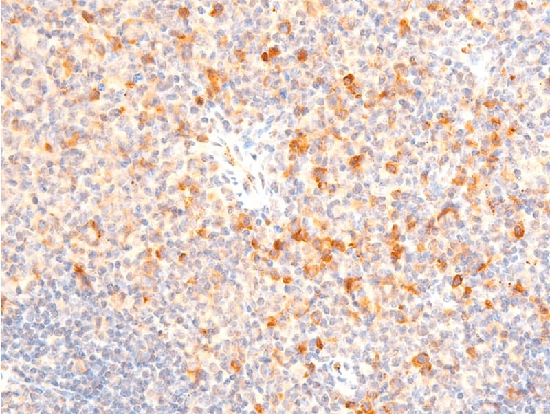 SGK1 / SGK Antibody (phospho-Ser422)