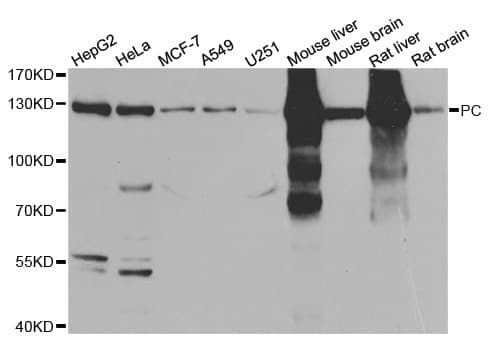 IHC-plus™ PC / Pyruvate Carboxylase Antibody