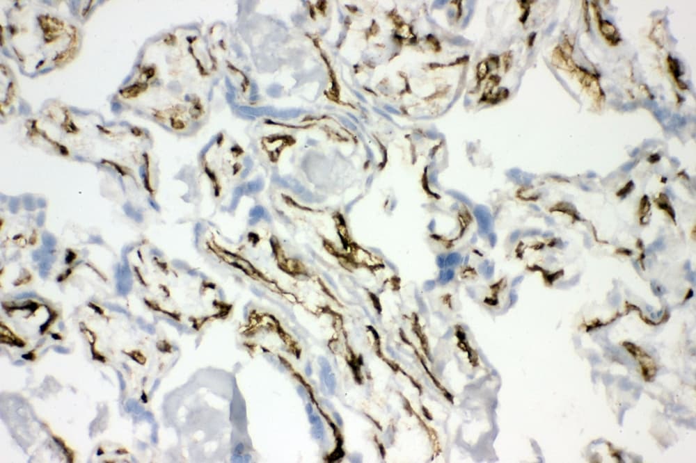 CAV2 / Caveolin 2 Antibody (aa1-162)
